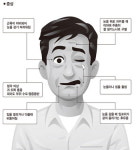 [동국대학교 경주한의원의 한의학 이야기] 안면마비