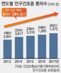 [건강칼럼] 안구건조증
