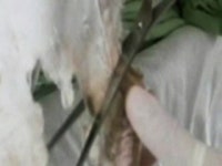 서울대병원 세탁물 슈퍼박테리아 원인균 검출 논란