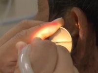 노년기에 단백질·지방 섭취 적으면 난청 위험↑