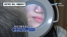 극단적인 채식, 위험하다?
