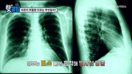 라돈이 위험한 이유는 무엇일까?