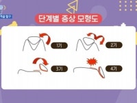 [슬기로운 펫생활] 슬개골 탈구