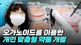 오가노이드를 통한 맞춤형 신약 개발