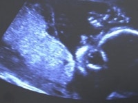 보호출산제 내일부터 시행...쉽게 양육 포기 우려도