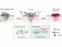 나노입자로 슈퍼박테리아 제거하는 치료법 개발