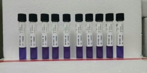 메르스 바이러스는 소독 아닌 ‘멸균’으로 박멸