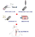 서울대병원 정은재 교수, 인공식도 개발…동물실험 성공