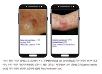 분당서울대병원, 134개 피부질환 진단하는 인공지능 개발
