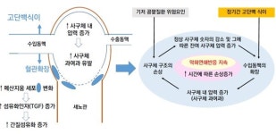 고단백 장기 섭취 시 콩팥 기능 감소 위험 높인다
