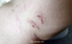 천안시, 삼룡천 인근 주민 목줄 없는 푸들에 덜덜