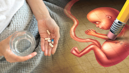 태아 죽이는 낙태약, 클릭 한 번에 불법 유통