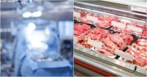 “현재 OO 성형외과에서 정육점 직원이 수술하고 있어요“