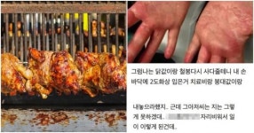 “주인 없기에 직접 통닭 꺼내다가 큰 화상… 치료비 기어코 받아냈습니다” (사진)