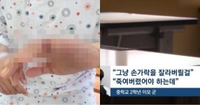 교실서 커터칼 휘둘러 응급수술 상황… 가해 학생이 받은 처분, 좀 당황스럽다