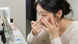 콘택트렌즈 싸게 사려고 직구했는데… 식약처 경고, 이것 모르면 큰일 납니다