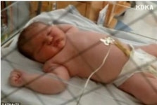 6.2kg 신생아 탄생, 태어나자마자 2살 포스 작렬