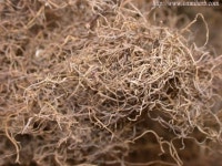 노교수의 난치병 한약치료 이야기 공황장애의 원인