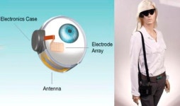 美인공망막 개발사, 기술 지원 중단…350명 이식 환자 표류