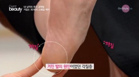 올바른 발 건강관리, 썸남썸녀 확 깨는 순간 발 뒤꿈치 각질…매끈 발 관리법은?