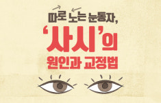 따로 노는 눈동자, ‘사시’의 원인과 교정법