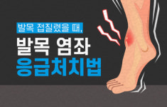 발목 접질렸을 때, 발목 염좌 응급처치법