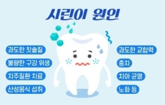 이가 시린 이유, ‘시린이 치약’ 쓰면 좋아질까?