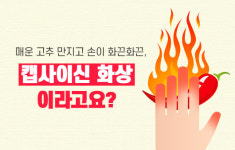 고추 손질하고 손이 화끈화끈, 캡사이신 화상이라고요?