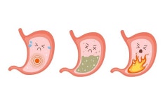 “소화불량 증상 있다면?”…‘위장 건강’에 좋은 성분 3가지