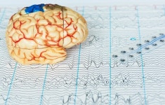 4대 신경계질환 ‘뇌전증’② “일상생활을 가능케 하는 진단과 치료”