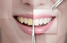 “정말 하얘질 수 있을까?”…‘치아미백’ 종류별 효과 및 주의사항