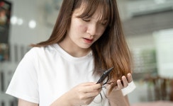 여성 탈모 늦추려면... 인터넷 정보보다 전문의의 진단으로 치료해야 ② [인터뷰]