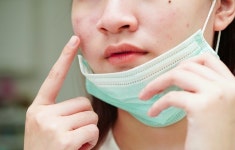 속은 건조한데 피지도 많아…‘수부지’ 피부, 여드름 관리 어떻게?