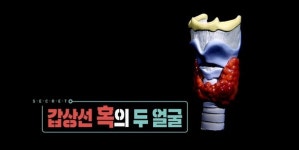 생로병사의 비밀 갑상선암은 착한암? 갑상선 혹의 두 얼굴, 오해와 진실