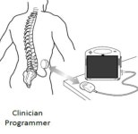 고령화 시대 수요 확대되는 유망 의료기기는?