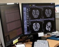 비트컴퓨터 컨소시엄, 병원간 진료정보교류시스템 사업 수주