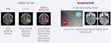 다원메닥스, 교모세포종 붕소중성자포획치료 임상 개시