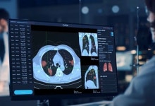 의료현장 속 깊숙이 스며든 AI 기술...요란 떨다가 사라진 왓슨