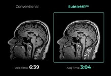 메디칼스탠다드, MRI 영상복원 SubtleMR 국내 공급