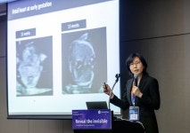 GE 헬스케어코리아, 고위험 산모 케어 초음파 솔루션 공유