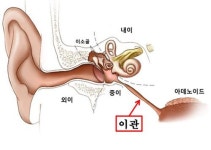[제주, 제주인의 건강보고서Ⅵ](25)이관기능 장애