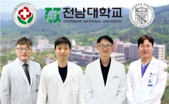 전남대-화순전남대병원 연구팀 폐암 면역치료 시간 중요성 규명