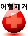 통증치료 어혈치료에 침과 부항이 매우 효과적