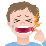 구내염과 비슷해서 구별하기 어려운 구강암 증상