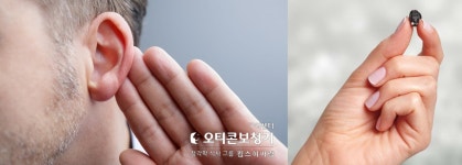 오티콘보청기 구리센터, 유명 가수도 경험한 돌발성 난청 치료 후에도 청력이 회복 안 된다면?
