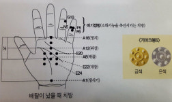 [원포인트건강] 배탈 났을 때 수지침·이쑤시개로 손끝 눌러주면 효과