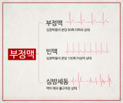 돌연사 원인 90% ‘부정맥’이라는데…치료 및 예방법은?