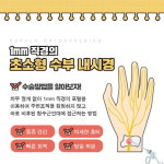 ‘손목 통증’ 손목터널증후군, 미세수부내시경 치료 효과와 주의사항