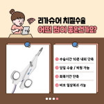 치질수술, 리가슈어와 치핵절제술의 차이점