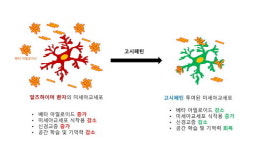 ‘히비스커스’가 뇌 면역세포 활성화…알츠하이머성 치매 물리친다